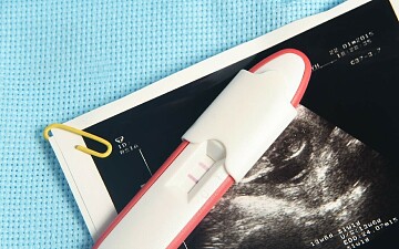 Особый случай: история беременности после неудачных ЭКО и криопереносов