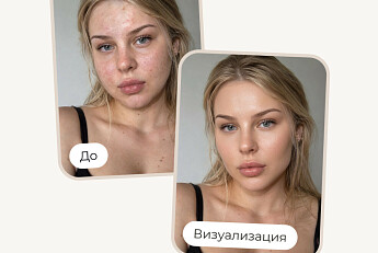 Восстановление по расписанию: кремы, маски и новинки, которые возвращают коже свежесть