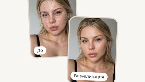 ИИ в сфере красоты: клиника запустила бота для первичной диагностики внешности